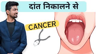 Daant Nikalne se Cancer Hota Hai Expert Reveals the TRUTH [upl. by Elke]