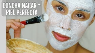 Elimina Cicatrices De Acne Estrias y Aclarar La Piel Con Concha Nacar En 1 Semana [upl. by Nosloc800]