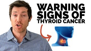 Thyroid Cancer Symptoms amp Early Warning Signs [upl. by Rednal]