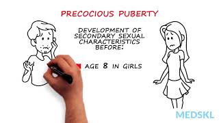 Pediatrics – Abnormal Pubertal Development By Paola Luca MD [upl. by Searle]