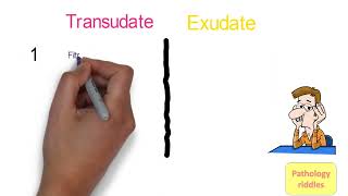 Edema Pathology Part  3 Hemodynamics Transudate versus Exudate Fmge Neet PG usmle Pathology Notes [upl. by Iztim]