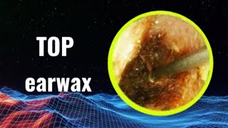 My fathers earwax changed me [upl. by Aihsrop421]