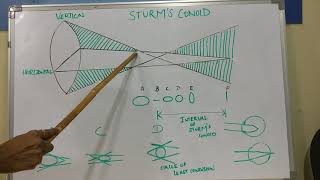 optometry insights Sturms conoid [upl. by Farmann]