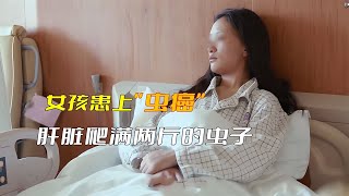 女孩患上“蟲癌”，醫生開刀一看，肝臟爬滿重達兩斤蟲子 漫畫 漫畫解說 穿越 國漫 熱血 [upl. by Ajnotal]