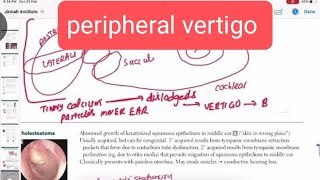 peripheral vertigo otorhinolaryngology 8  First Aid USMLE Step 1 in UrduHindi [upl. by Centonze]