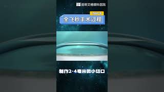 动图演示全飞秒手术全过程 近视手术 科普 分享 [upl. by Kiele50]