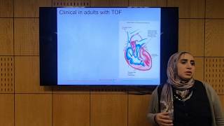 Fallot Tetralogy Part 1  Soha Romeih [upl. by Ahsikahs]