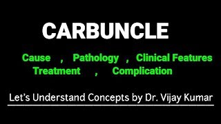 Carbuncle  Carbuncle Clinical Features  Carbuncle Treatments  Carbuncle Ka Ilaj [upl. by Trebbor332]