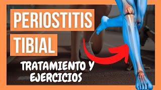 🦵PERIOSTITIS TIBIAL 💥 Qué es Causas Ejercicios y Tratamiento [upl. by Vasileior]