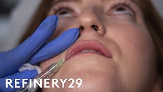 I Got Lip Filler Injections For The First Time  Macro Beauty  Refinery29 [upl. by Porche]