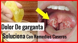 Alivia El Dolor De Garganta En 2 Horas 5 Remedios Caseros [upl. by Fanya]