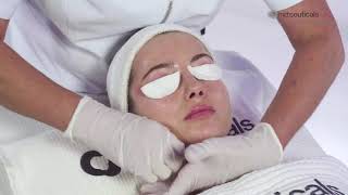 md Tranex Retipeel Treatment [upl. by Sosthenna]