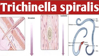 How Trichinella Spiralis Can Transform Your Body Ahmaric Tutorial [upl. by Wester]