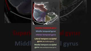 Temporal Lobe Anatomy on imaging [upl. by Naitsihc]