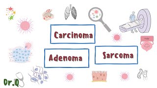 Carcinoma vs Adenoma vs Sarcoma  little differences  Cancertumor MyClinicalBook [upl. by Wu]