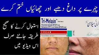 Trimelasin cream review  Trimelasin Cream Benefits In Urdu  Trimelasin Cream For Whitening [upl. by Inej797]