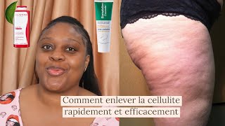 4 produits remède pommades pour enlever la cellulite rapidement et efficacement  angele De Gides [upl. by Ennahteb20]