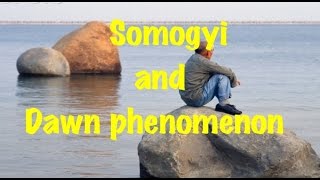 Medical Video Lecture Somogyi effect Vs Dawn Phenomenon [upl. by Atika]