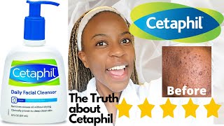 Cetaphil Skin Care Cleanser Review  Agnater [upl. by Marsiella]