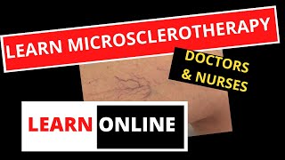 Learn Microsclerotherapy with Online Courses [upl. by Naik558]