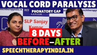 BeforeAfter  Vocal Cord Paralysis Treatment  Phonatory Gap  Within 8 Days  By slpsanjaykumar [upl. by Jemie]