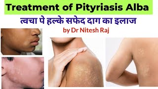 सफेद दाग का इलाजPityriasis Alba treatment in hindi drniteshraj [upl. by Otrebron]