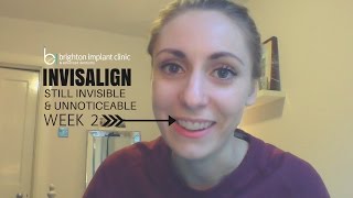 Invisalign Treatment Vlog After 2 weeks [upl. by Nalliuq259]