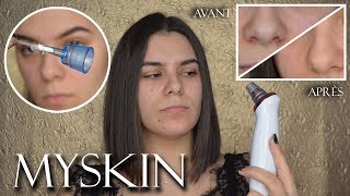 JE TESTE LASPIRATEUR À POINTS NOIRS  MYSKIN [upl. by Tedric204]