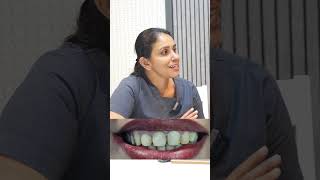 Dental veneers procedure for smile correction dentalexperience [upl. by Arnst]