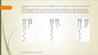 Die Ganganalyse [upl. by Stoneham158]