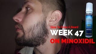 Minoxidil Beard  Week 47  Minoxidil 5 for Beard Growth  Facialfuzzfridays [upl. by Serilda]