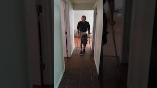 My first time walking with hip disarticulation prosthetic c leg [upl. by Arjun993]