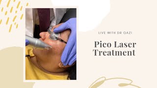 Pico Laser Treatment For Melasma LIVE [upl. by Nagyam]