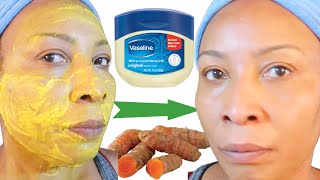 Mix Vaseline And Turmeric And You Will Be Shocked Instant Glowy Skin Face and Neck [upl. by Ballman811]