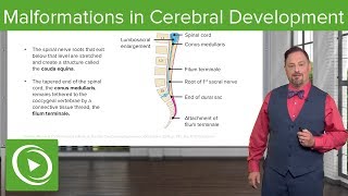 Malformations in Cerebellar Development – Embryology  Lecturio [upl. by Arodnahs815]