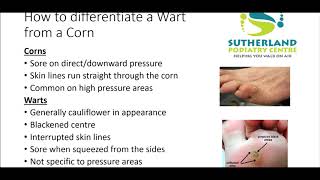 What Is The Difference Between a Wart and a Corn [upl. by Azyl]