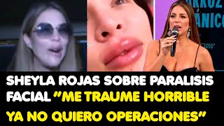 SHEYLA ROJAS SOBRE PARALISIS FACIAL “ME TRAUME HORRIBLE YA NO QUIERO OPERACIONES” [upl. by Macur590]