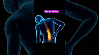 Causes of Back Pain  viralshorts [upl. by Gebler182]