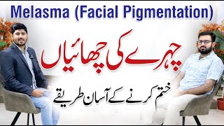 Melasma Causes  How To Treat Pigmentation  Dr Danial Ahmed with Dr AR Madha [upl. by Banna]