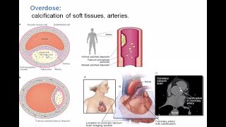 Biochemistry Lecture  Role of Minerals in Hypertension  Indian Medical  Ample Medical Lecture [upl. by Ahsilif]