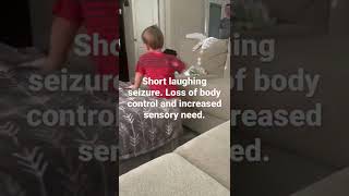 Laughing seizure Gelastic seizure resulting from hypothalamic hamartoma [upl. by Bremble]