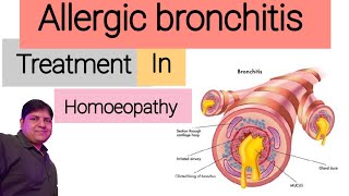 Homeopathic medicine for Allergic Bronchitis  Allergic Bronchitis Treatment in Homeopathy  Hindi [upl. by Aerahs148]