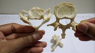 Vertebrae  Identification Features amp Differences [upl. by Chuu]