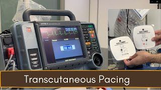 Crash Cart 04 Transcutaneous Pacing TCP [upl. by Annaira]