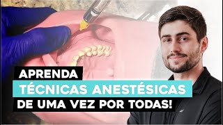 Guia Completo Técnicas Práticas de Anestesia em Odontologia [upl. by Ttelrahc]