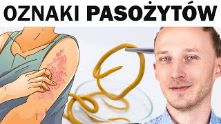 Objawy że pasożyty grasują w jelitach Jak je wygonić [upl. by Mckee]