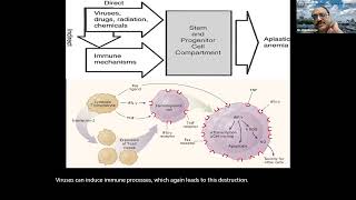 6 Pancytopenia Diagnosis Approach and Treatment of Aplastic Anaemia 27th April 2022 [upl. by Lowry]