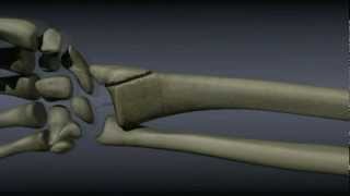 Surgical Treatment of Distal Radius Fractures [upl. by Fortuna]