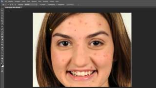 Come eliminare i brufoli e altre imperfezioni da una foto con Photoshop [upl. by Mendes]