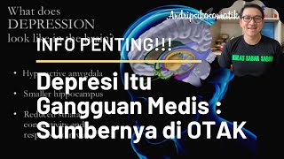 Penting Diketahui Depresi Itu Gangguan Medis  Sumbernya Ada di Otak [upl. by Aneem933]